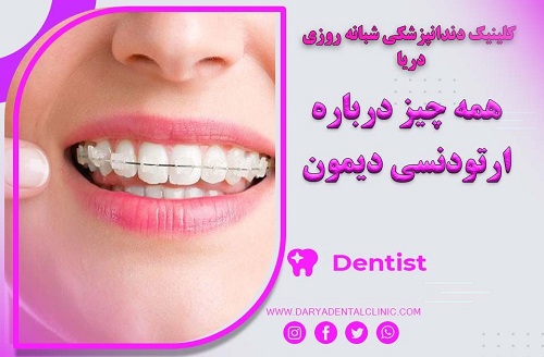 همه چیز درباره ارتودنسی دیمون